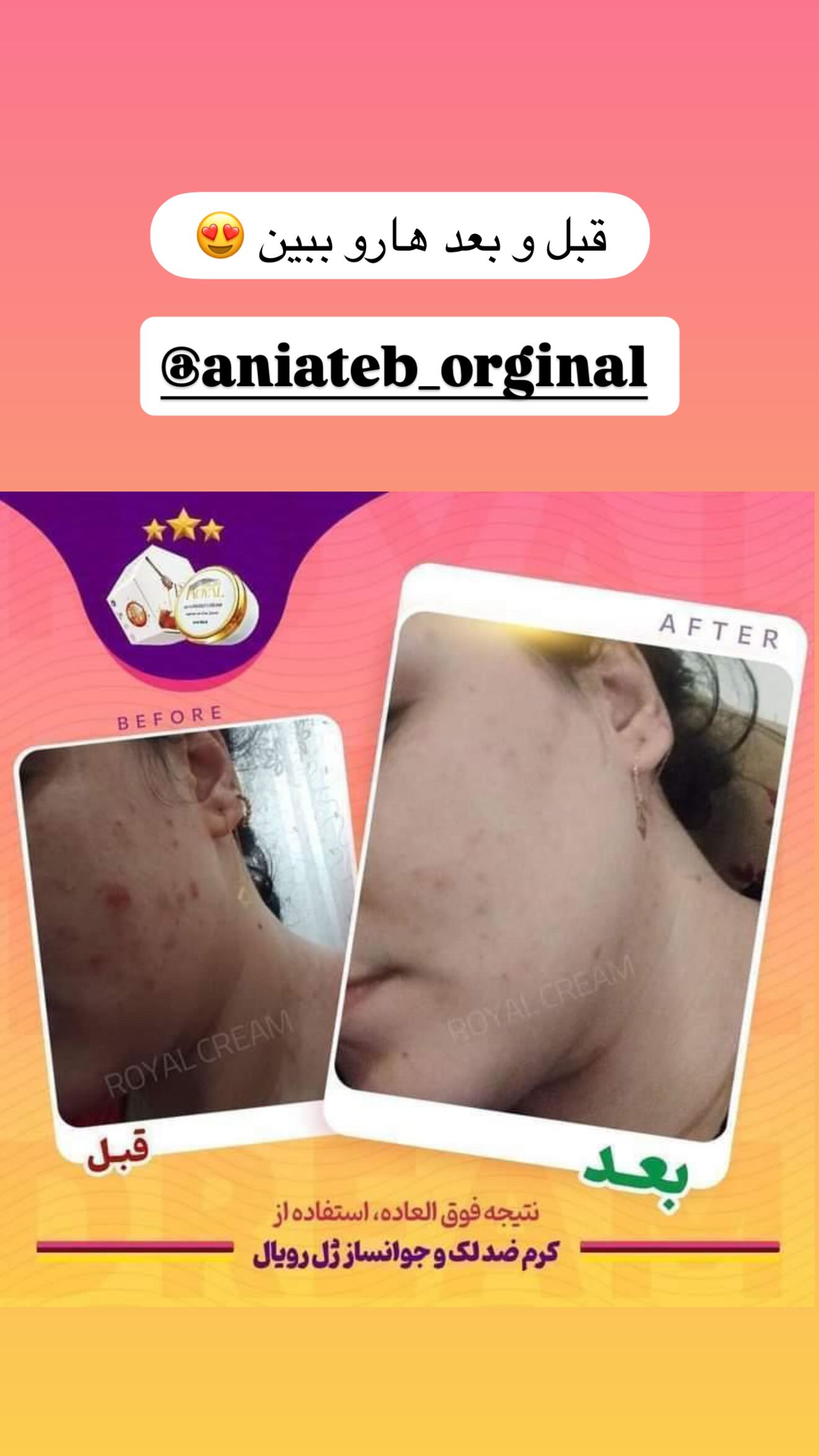  جدید ترین استوری اینستاگرام مائده عابدی