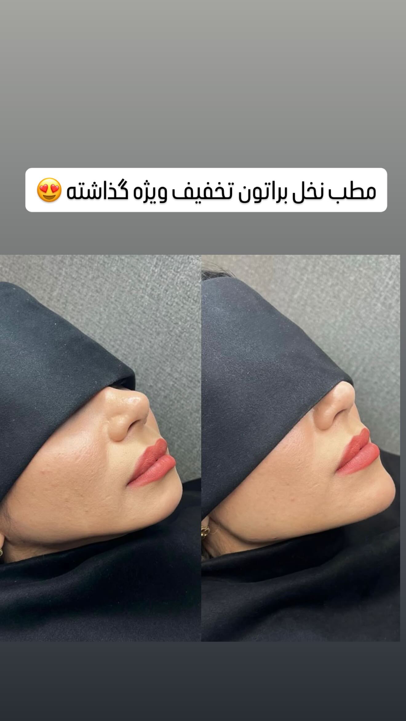  جدید ترین استوری اینستاگرام مائده عابدی