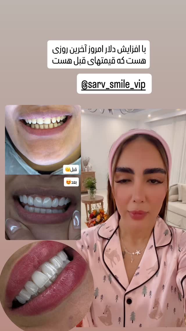  جدید ترین استوری اینستاگرام مائده عابدی