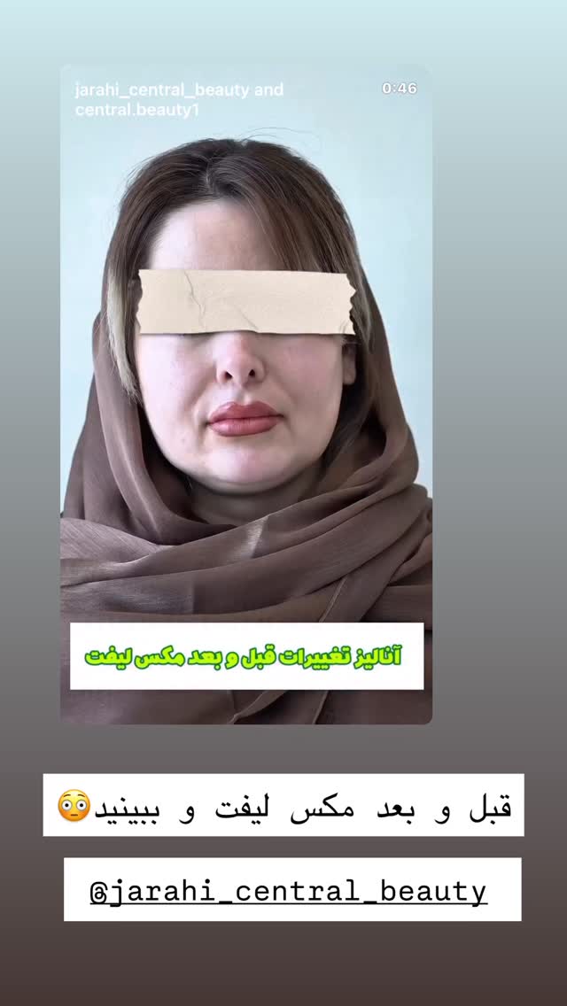  جدید ترین استوری اینستاگرام مائده عابدی