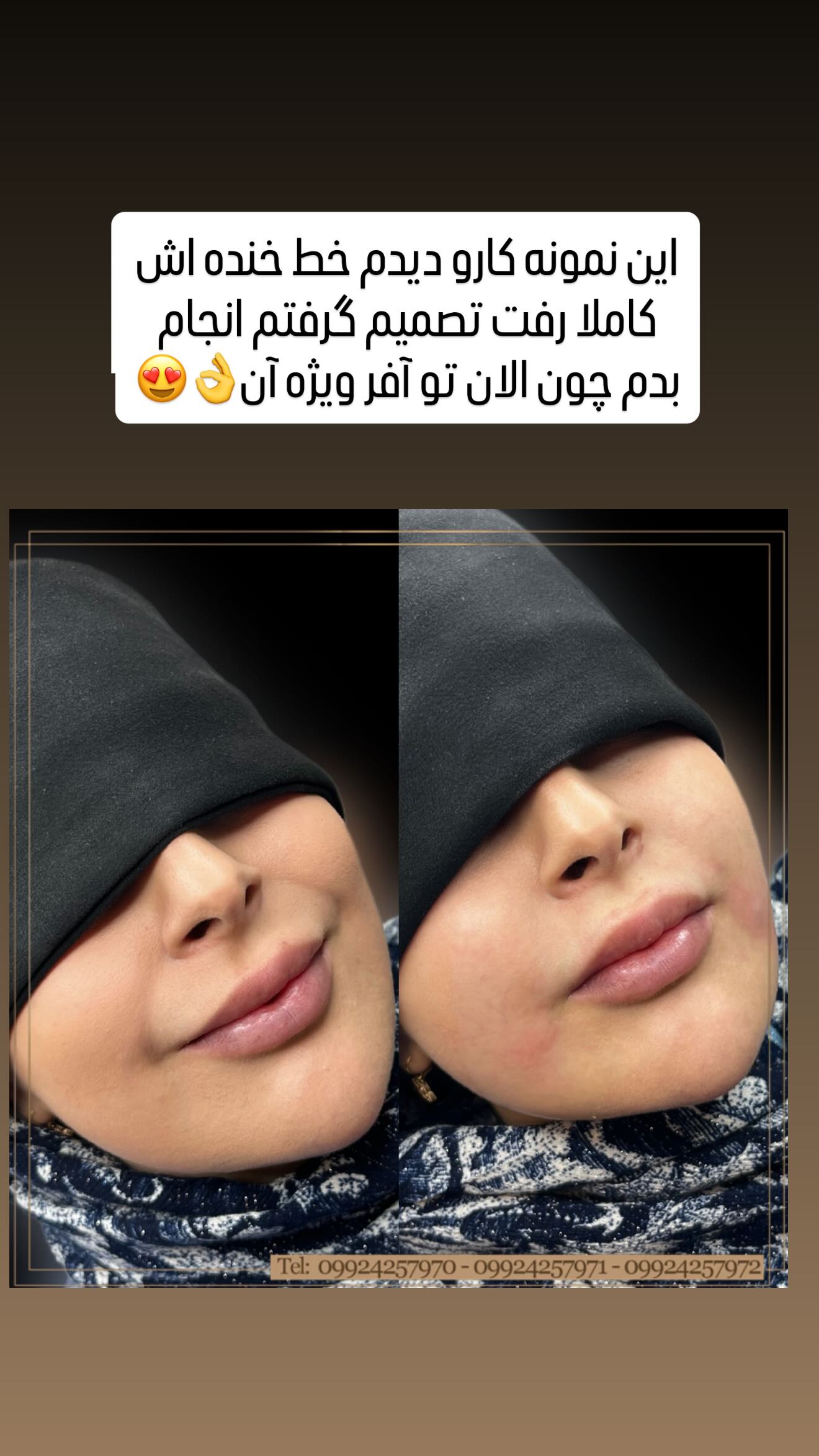  جدید ترین استوری اینستاگرام مائده عابدی