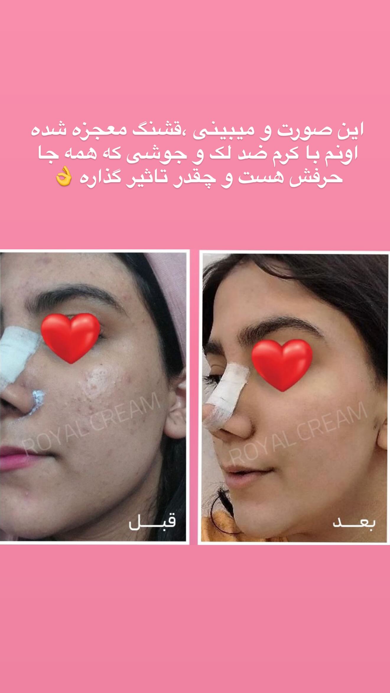  جدید ترین استوری اینستاگرام مائده عابدی