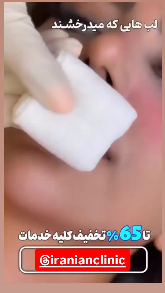  جدید ترین استوری اینستاگرام مهدی محمودی