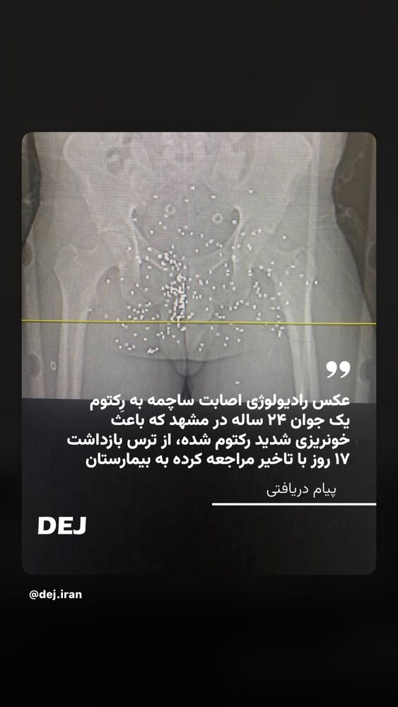  جدید ترین استوری اینستاگرام عباس غزالی
