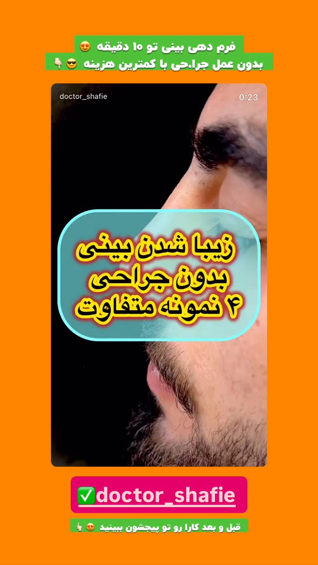  جدید ترین استوری اینستاگرام افشین فدام