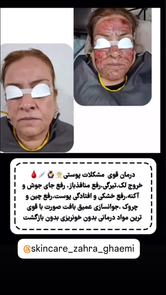  جدید ترین استوری اینستاگرام احمد رضا نیشابور