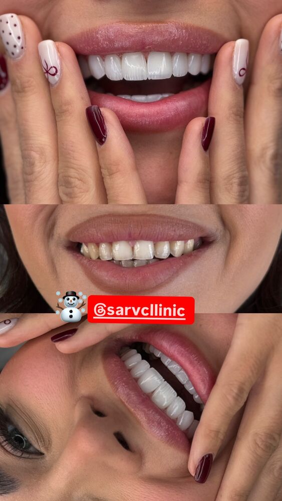  جدید ترین استوری اینستاگرام آهو