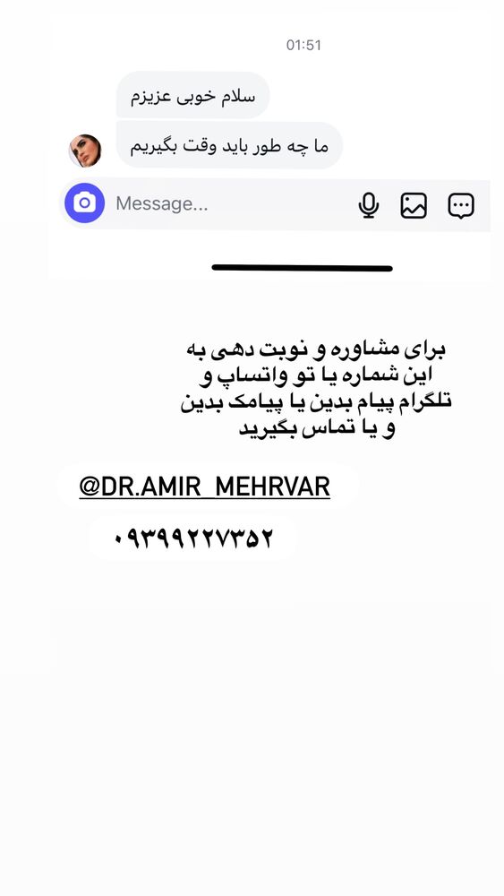  جدید ترین استوری اینستاگرام آهو