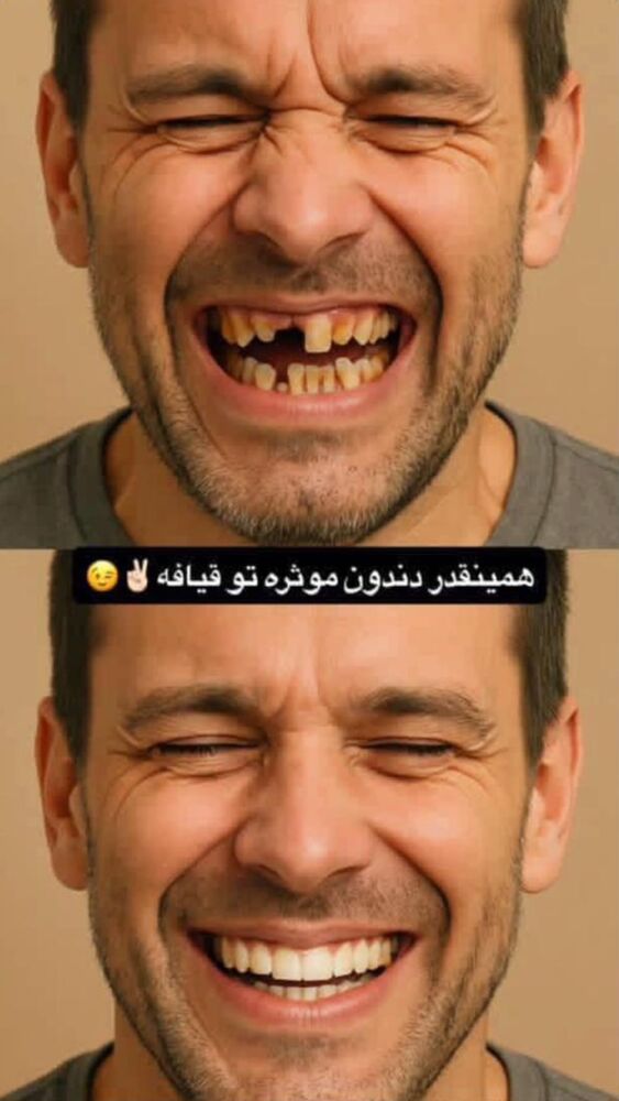  جدید ترین استوری اینستاگرام علی جی