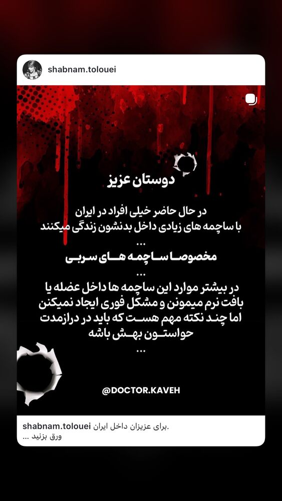  جدید ترین استوری اینستاگرام علی عظیمی