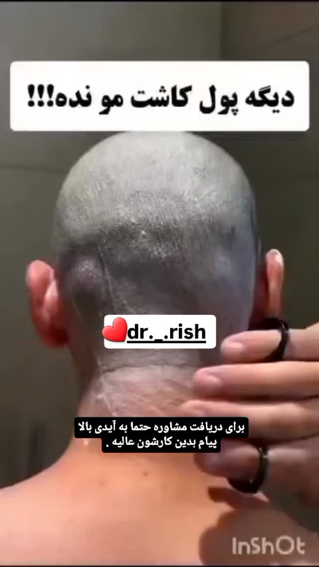  جدید ترین استوری اینستاگرام علیراد