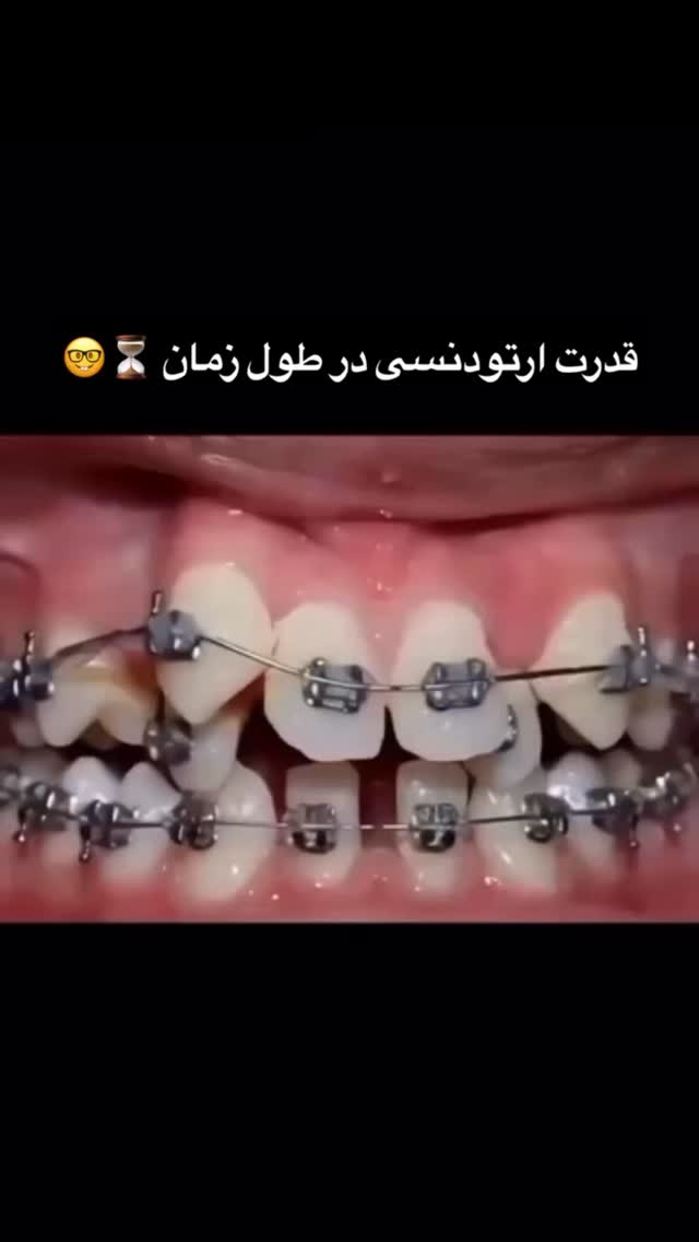  جدید ترین استوری اینستاگرام عمه