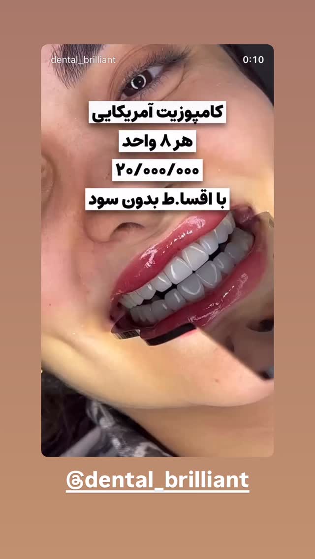  جدید ترین استوری اینستاگرام امیر حسین