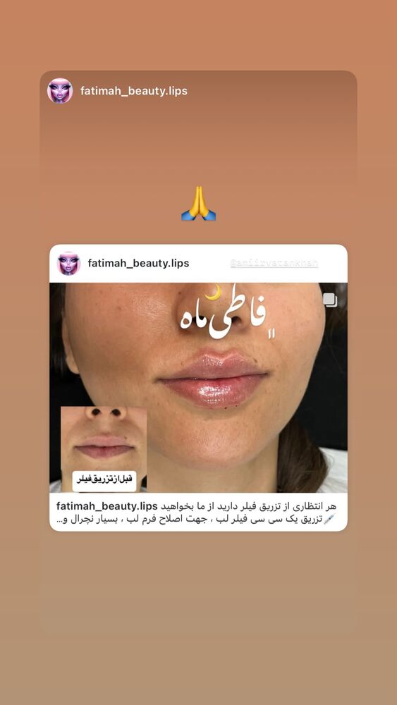  جدید ترین استوری اینستاگرام امیر وطن