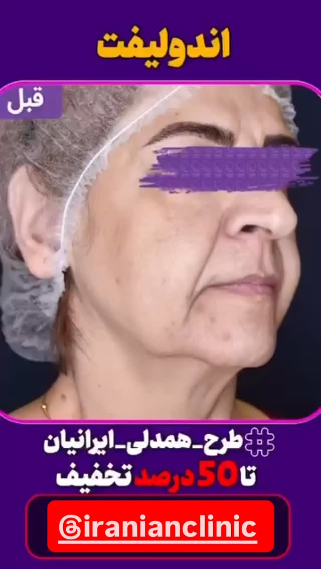  جدید ترین استوری اینستاگرام امیر وطن