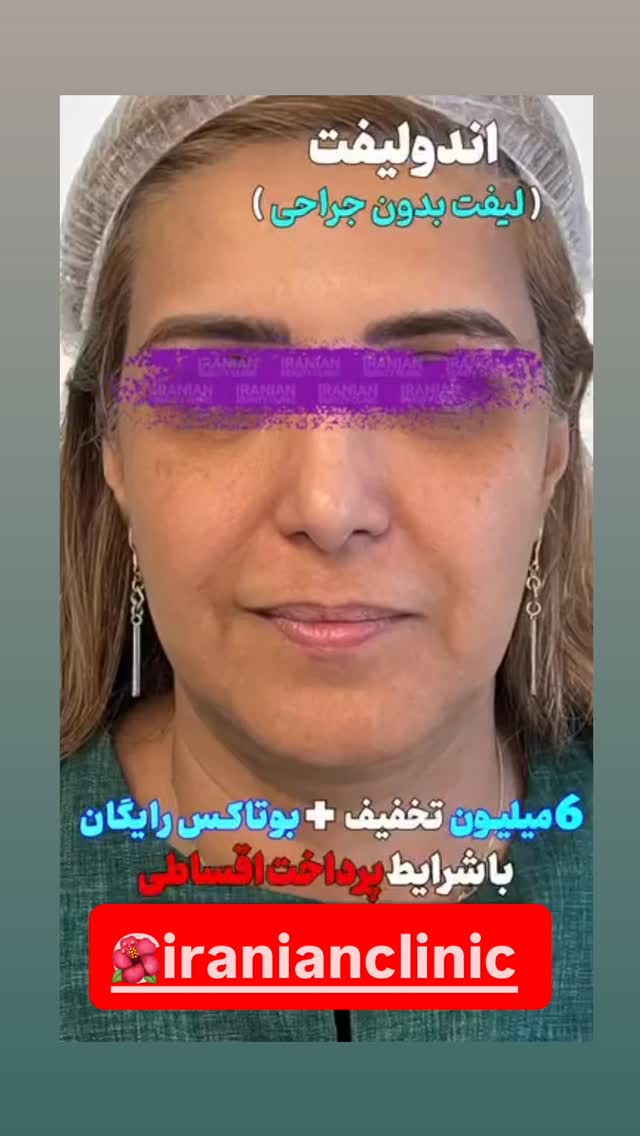  جدید ترین استوری اینستاگرام امير عزت زاده