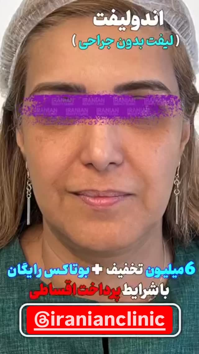 جدید ترین استوری اینستاگرام امير ولی زاده