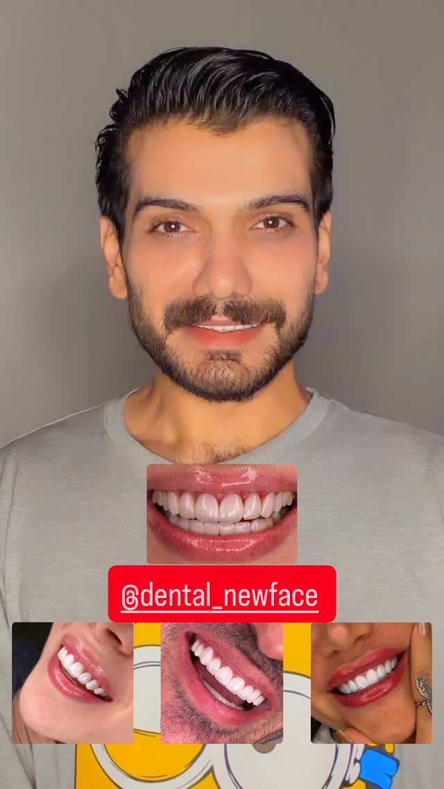  جدید ترین استوری اینستاگرام امیر سلیمانی