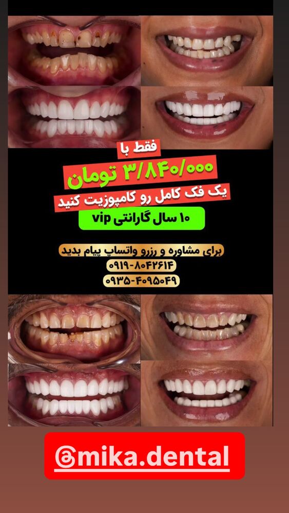  جدید ترین استوری اینستاگرام مستر امیر