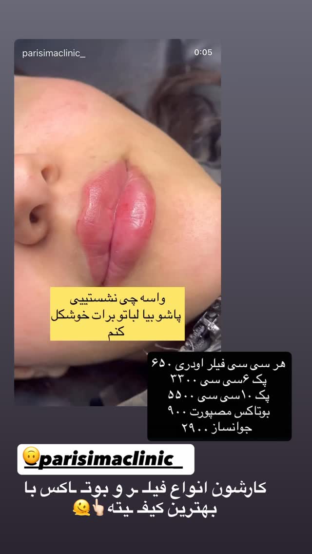  جدید ترین استوری اینستاگرام امیر و مبینا