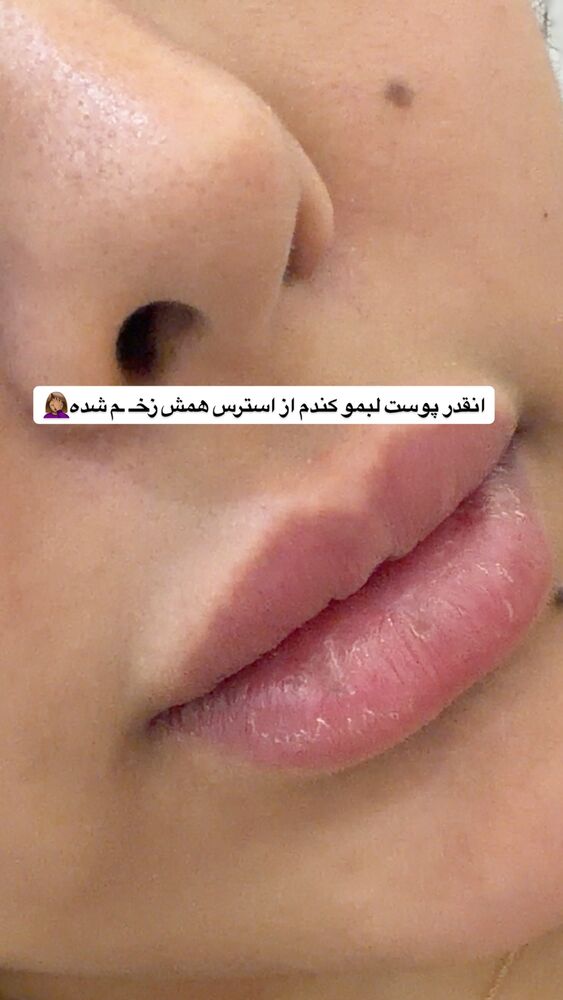  جدید ترین استوری اینستاگرام امیر و مبینا