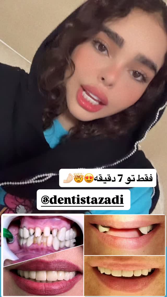  جدید ترین استوری اینستاگرام ساناز عباسی