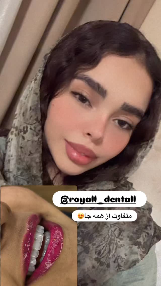  جدید ترین استوری اینستاگرام ساناز عباسی