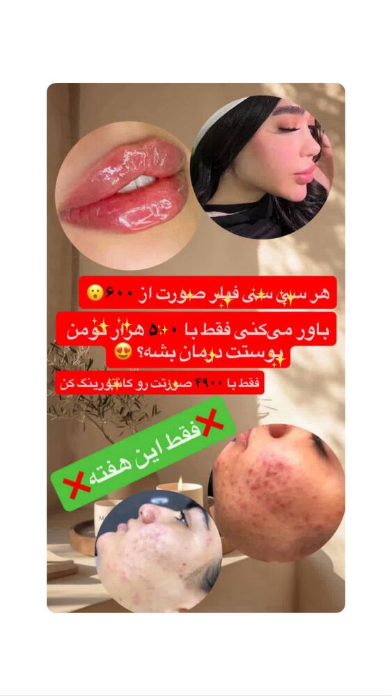  جدید ترین استوری اینستاگرام ساناز عباسی