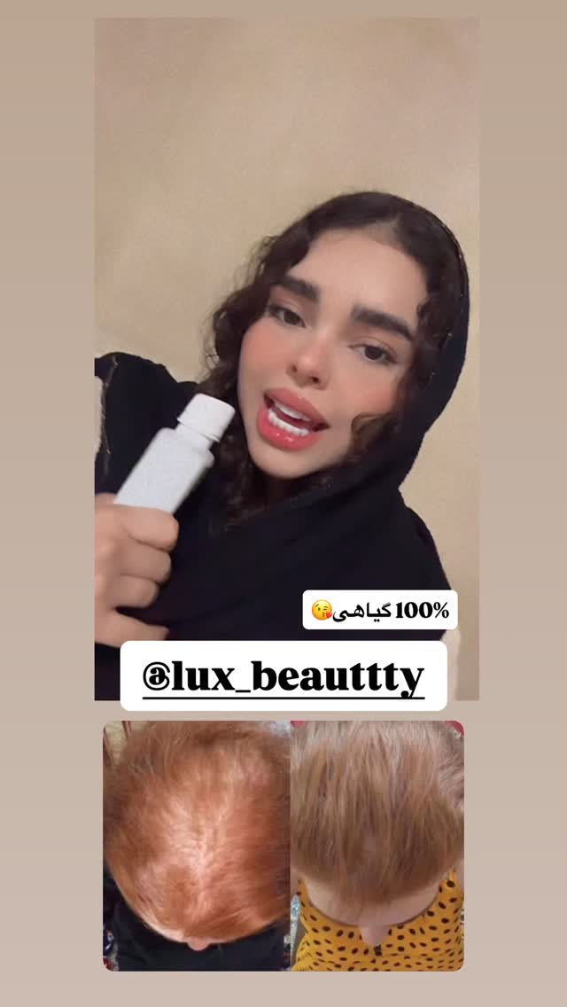  جدید ترین استوری اینستاگرام ساناز عباسی