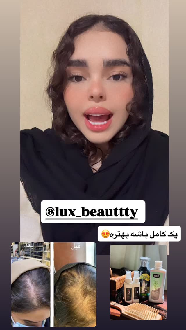  جدید ترین استوری اینستاگرام ساناز عباسی