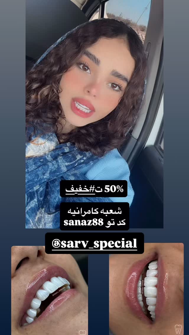  جدید ترین استوری اینستاگرام ساناز عباسی