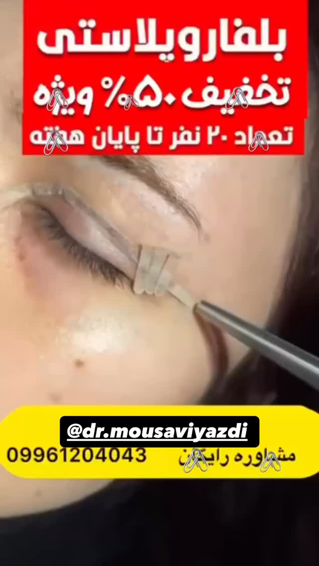  جدید ترین استوری اینستاگرام ساناز عباسی