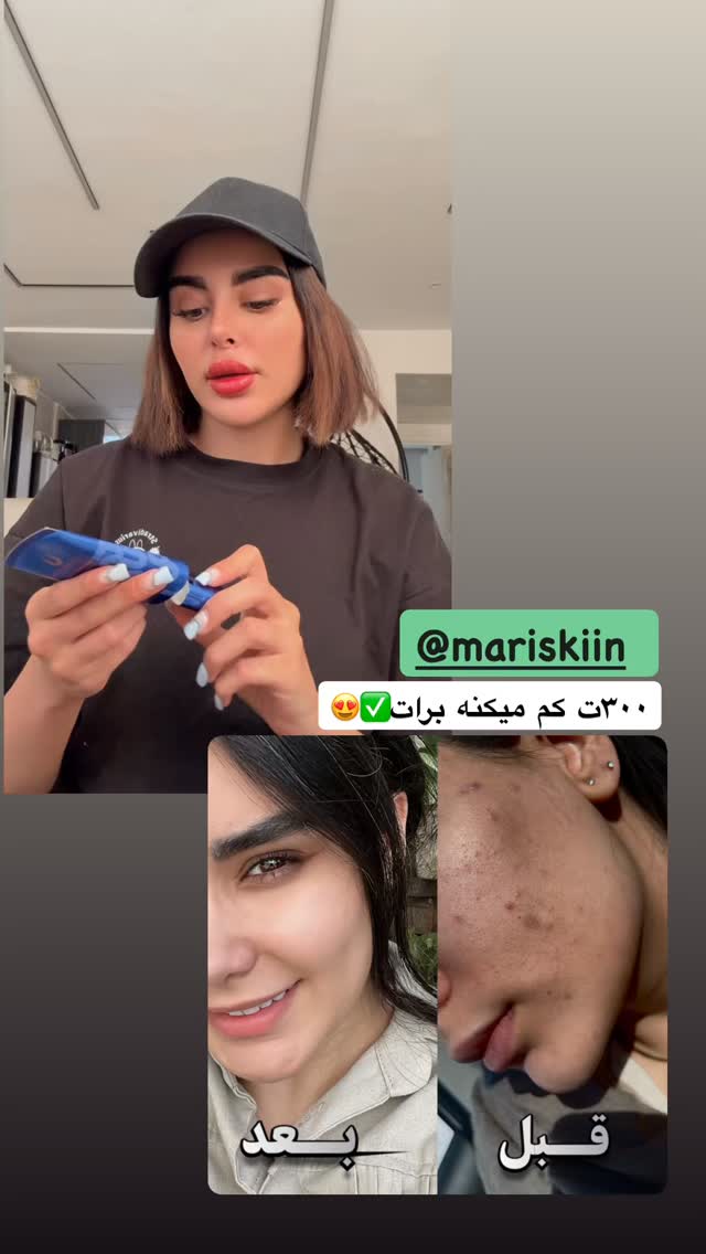  جدید ترین استوری اینستاگرام یگانه مرسلی