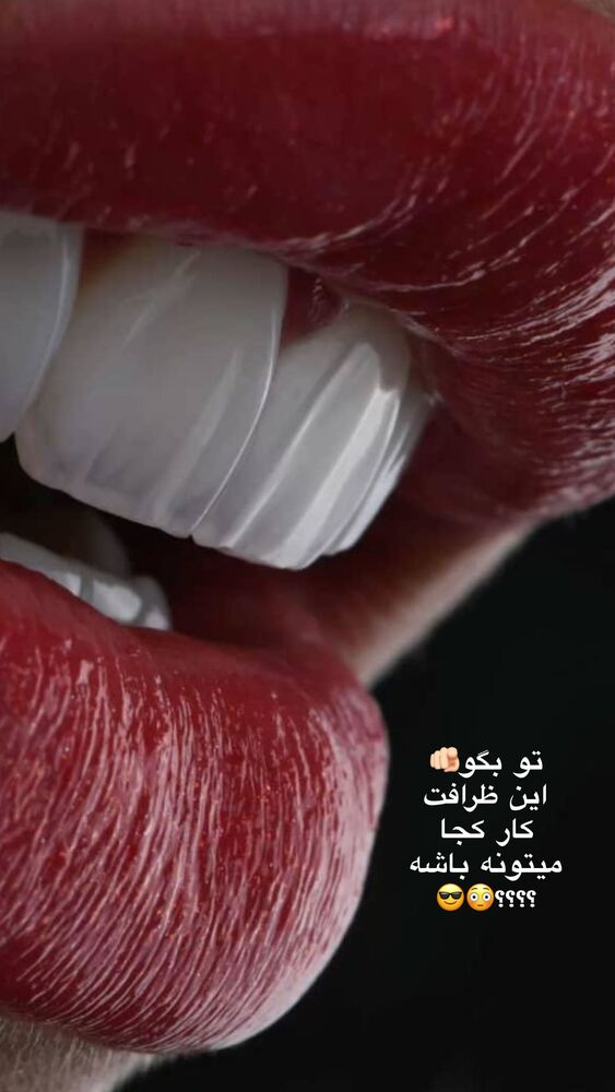  جدید ترین استوری اینستاگرام یگانه مرسلی