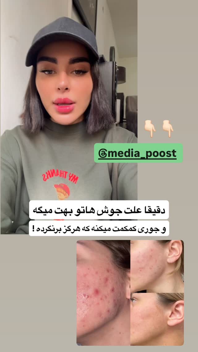  جدید ترین استوری اینستاگرام یگانه مرسلی