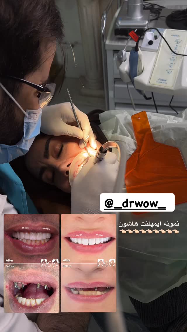  جدید ترین استوری اینستاگرام یگانه مرسلی