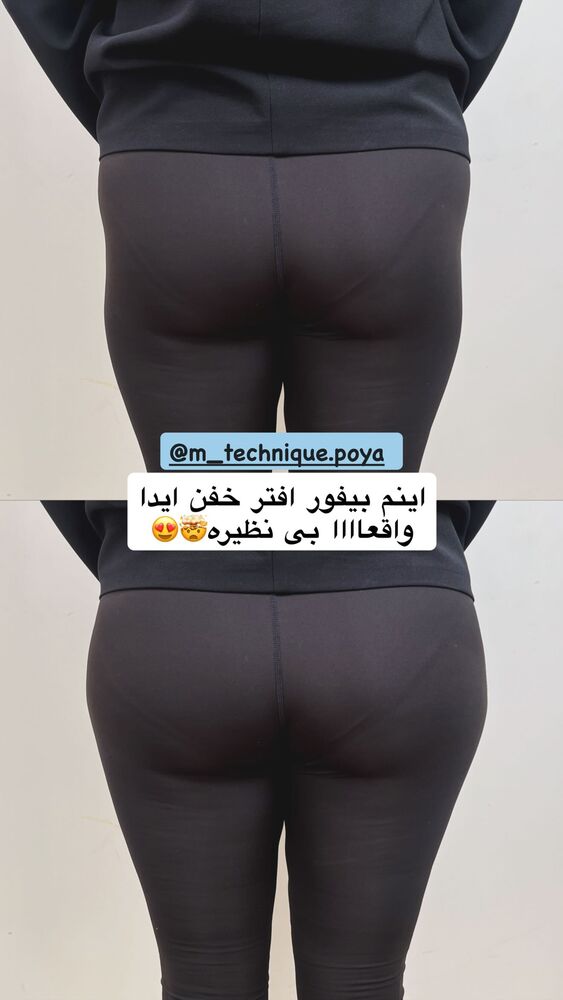  جدید ترین استوری اینستاگرام یگانه مرسلی