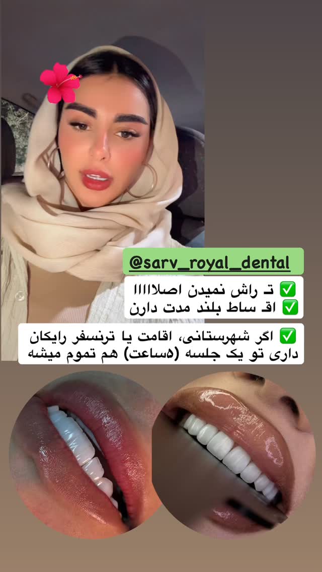  جدید ترین استوری اینستاگرام یگانه مرسلی