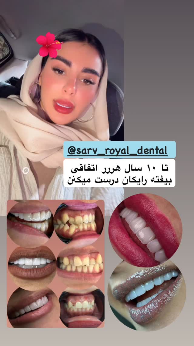  جدید ترین استوری اینستاگرام یگانه مرسلی
