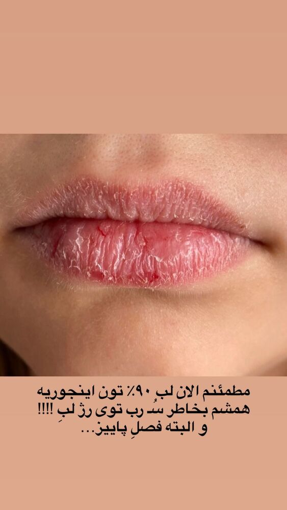  جدید ترین استوری اینستاگرام یگانه مرسلی