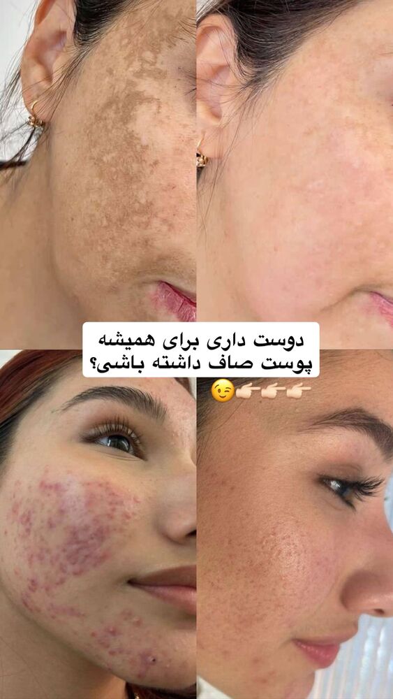  جدید ترین استوری اینستاگرام یگانه مرسلی
