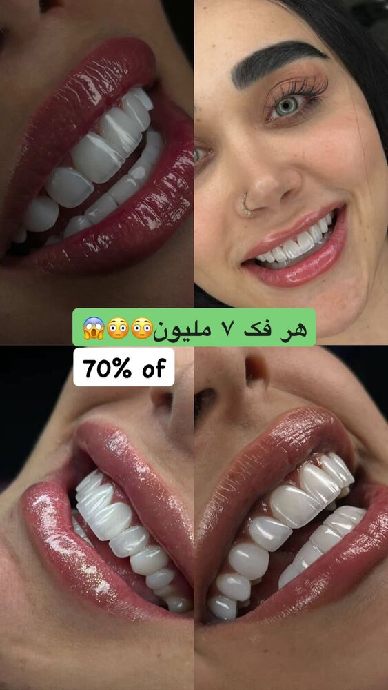  جدید ترین استوری اینستاگرام یگانه مرسلی