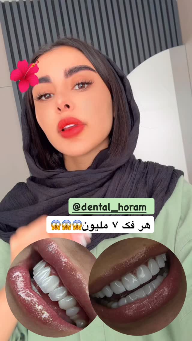  جدید ترین استوری اینستاگرام یگانه مرسلی