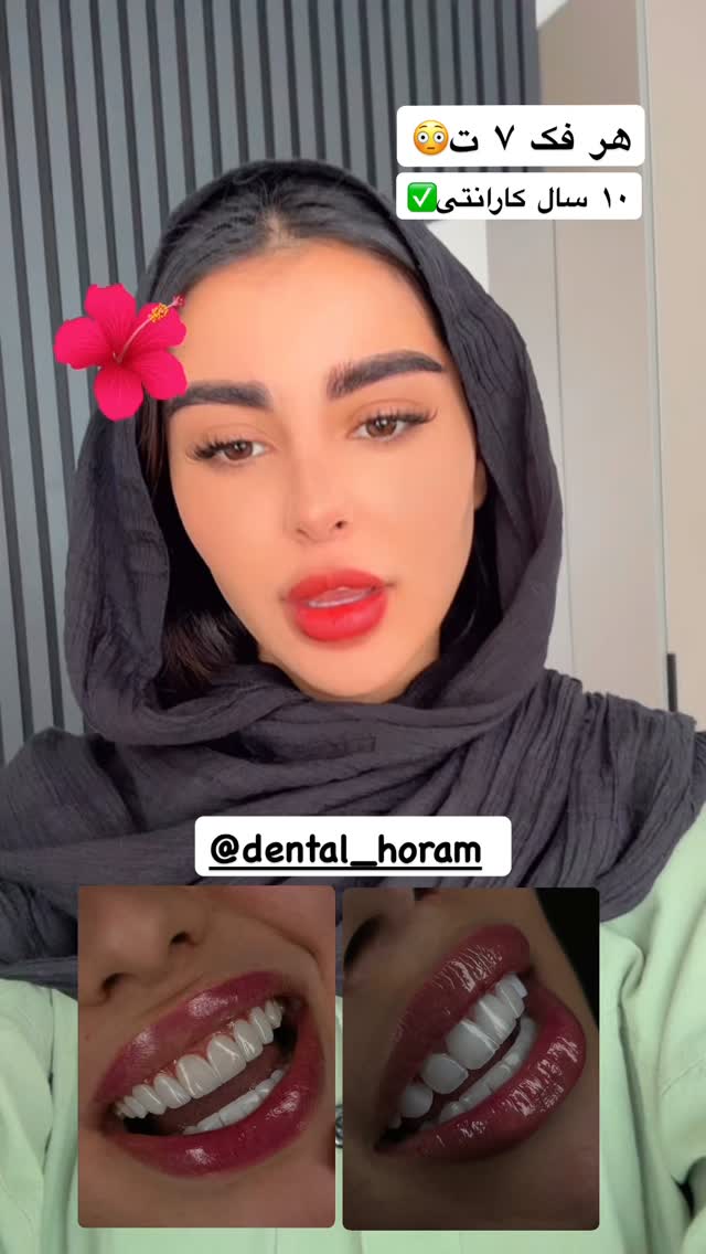  جدید ترین استوری اینستاگرام یگانه مرسلی