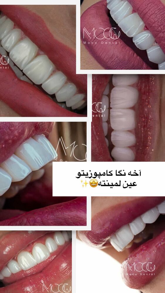  جدید ترین استوری اینستاگرام یگانه مرسلی