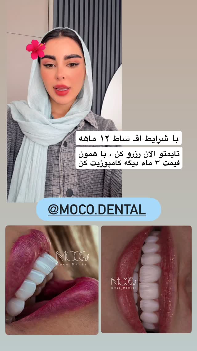  جدید ترین استوری اینستاگرام یگانه مرسلی