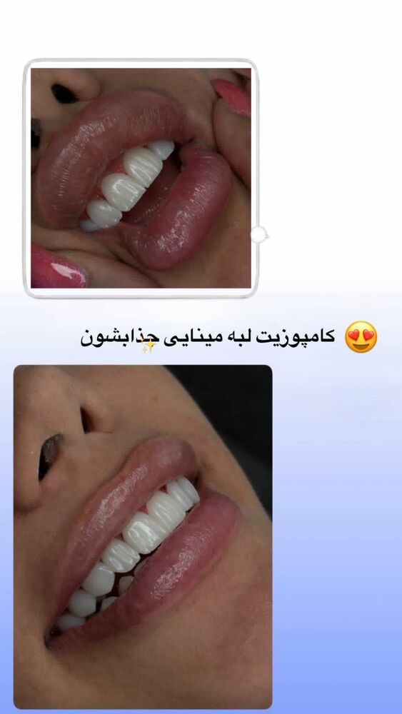  جدید ترین استوری اینستاگرام یگانه مرسلی