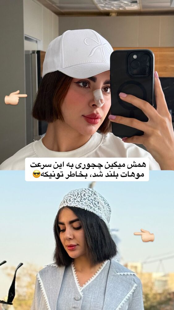  جدید ترین استوری اینستاگرام یگانه مرسلی