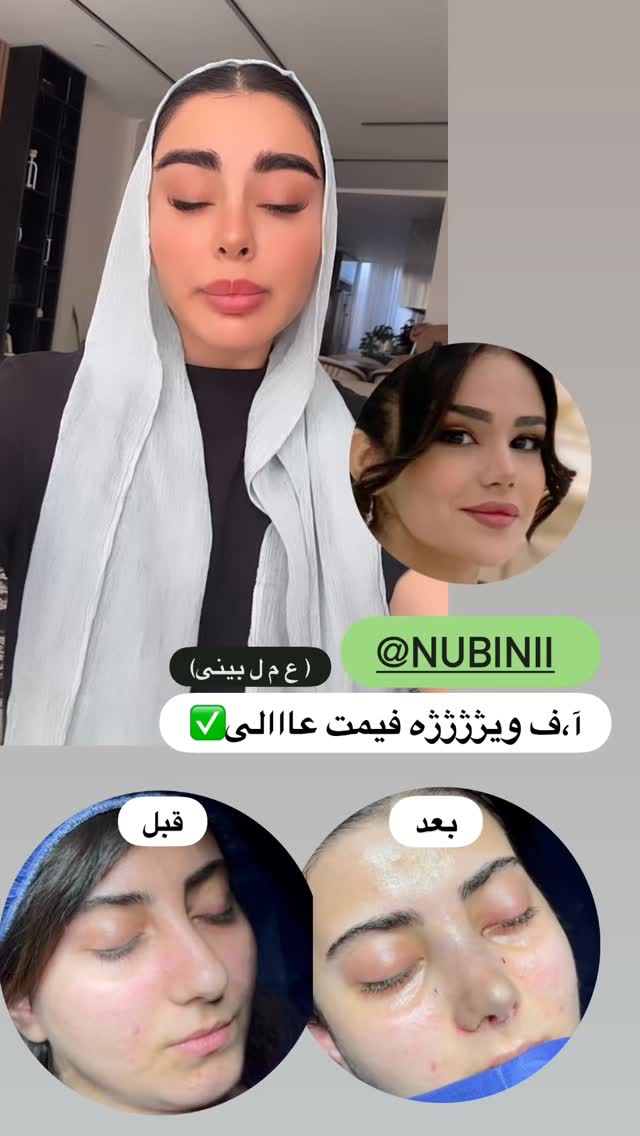  جدید ترین استوری اینستاگرام یگانه مرسلی