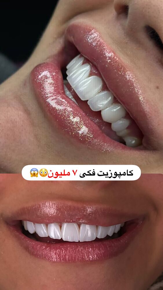  جدید ترین استوری اینستاگرام یگانه مرسلی